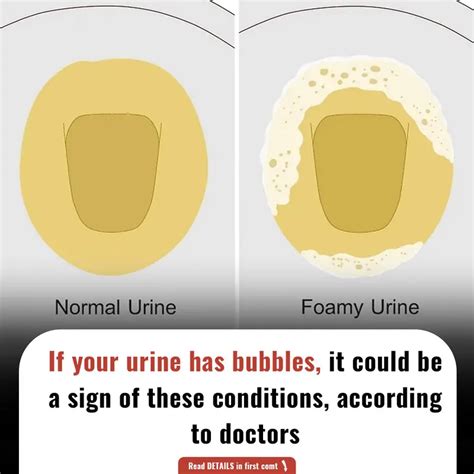 urine  bubbles     sign   conditions