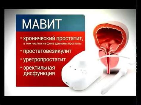 Аппарат физио-магнитной терапии ЕЛАТ (Мавит) УЛП-01 - YouTube