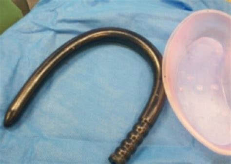 Doctors Horror As Inch Sex Toy Gets Stuck Inside Man RT UK News