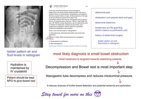 acute intestinal obstruction pathophysiology creative med doses
