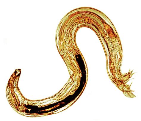 Old World Hookworm 1 Photograph By Cath Wadforthscience Photo Library