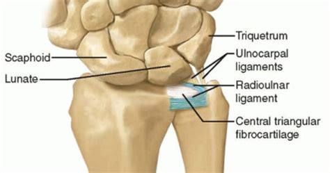 Tfcc Tears Treatment Options Sydney Physio Clinic