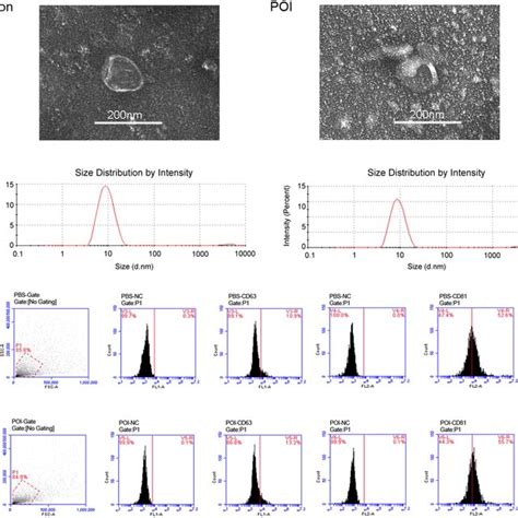 Isolation And Characterization Of Ovarian Exosomes A Electron