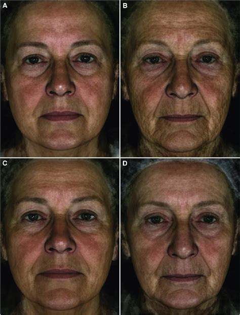 illustration   effect  wrinkling   wrinkling components