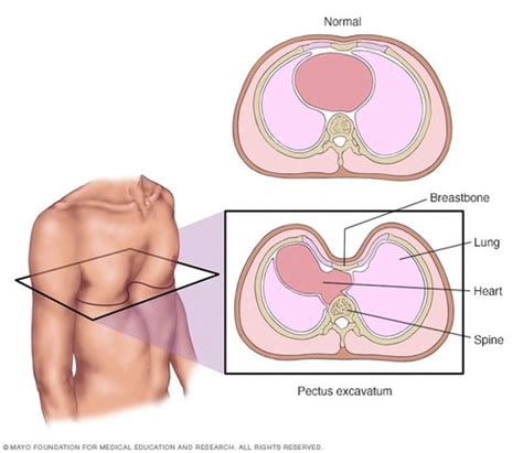 Thorax And Lungs Flashcards Quizlet