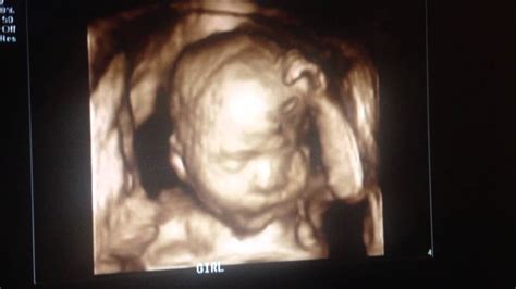 26 Weeks 4d Ultrasound Youtube