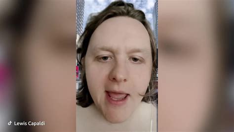 Lewis Capaldi Says Reason For Naked Billboard Was To Utilise His