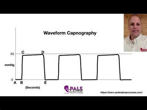 Waveform Capnography part 1 of 5 - YouTube