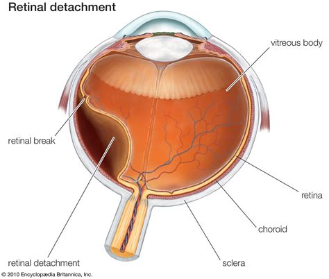 Vitreous Body Anatomy Britannica