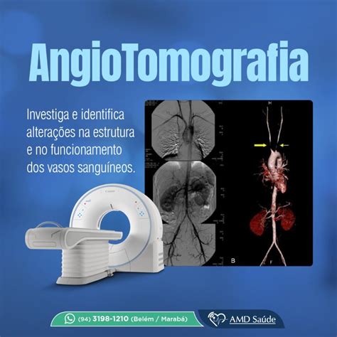 O Que Significa Angio - Angiotomografia: O que é, como funciona e o preparo • AMD Saúde