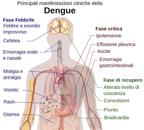 Dengue Farmaci Per La Cura Della Dengue