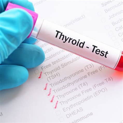 Thyroid Function Test (TFT) 1S - Pharma Xonline