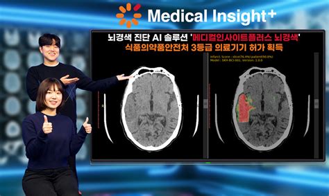 Sk Candc 인공지능 뇌경색 진단 솔루션 식약처 허가뇌출혈 진단 Ai에 이어 두번째