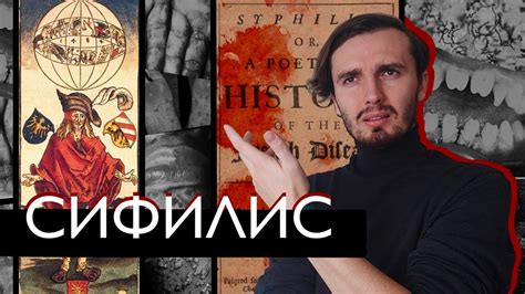 Сифилис: Напасть терзавшая Европу 500 лет! - [История Медицины] - YouTube