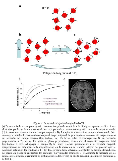 Resonancia Magn Tica Funcional Rmf Principios Y Aplicaciones En