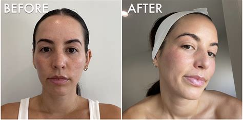 I Tried A Diamondglow Facial See Photos Popsugar Beauty