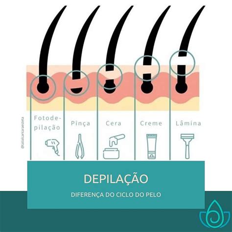 Tipos De Depilação Masculina - Aparelho de depilação masculina: tudo o que você precisa saber!