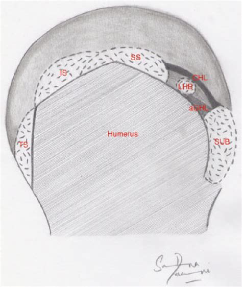 Rotator Cuff And Rotator Interval Anatomy Sagittal Section Of The
