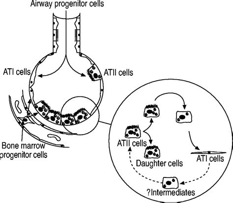 The Use Of Alveolar Epithelial Type I Cell Selective Markers To