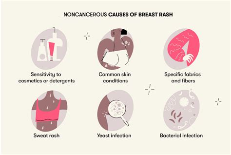 Rash Under The Breast Causes And When To See A Doctor Images