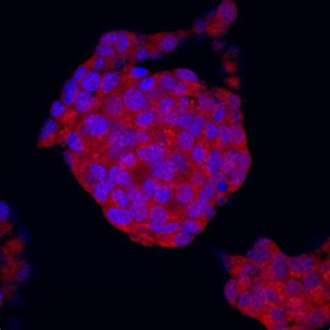 Humanmouserat Semaphorin 5a Antibody R D Systems 100μg Unlabeled