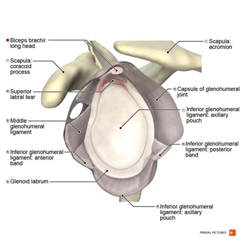 File Illustration Of Slap Ii Lesion Png Physiopedia