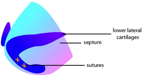 Rhinoplasty For The Nasal Tip Lam Facial Plastics