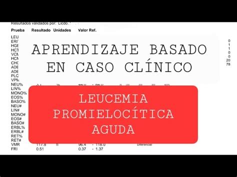 Leucemia Promieloc Tica Aguda Caso Cl Nico Youtube