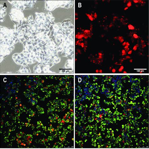 Expression of hepatic genes in HepG2 cells. (A) Morphology of HepG2... | Download Scientific Diagram