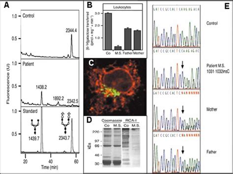 Universitätsklinikum Heidelberg Congenital Disorders of Glycosylation