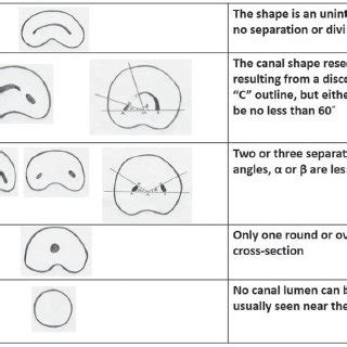 management   shape root canal configuration case reports