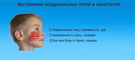 Детские спреи от насморка от 2 лет список лучших – 5 лучших препаратов ...