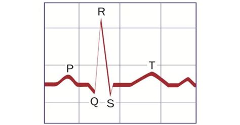 p wave  seismology assignment point