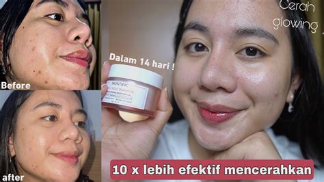 Review Skintific Msh Niacinamide Brightening Moisture Gel 10 X Lebih