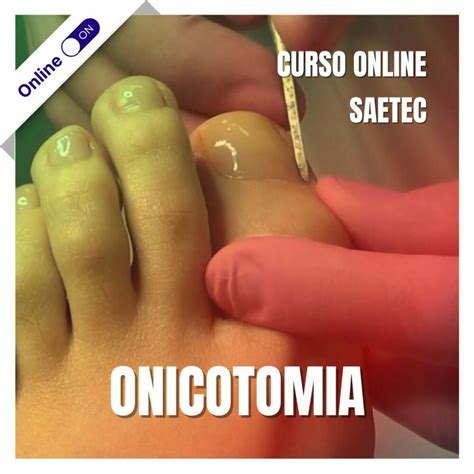 Curso De Podologia Online