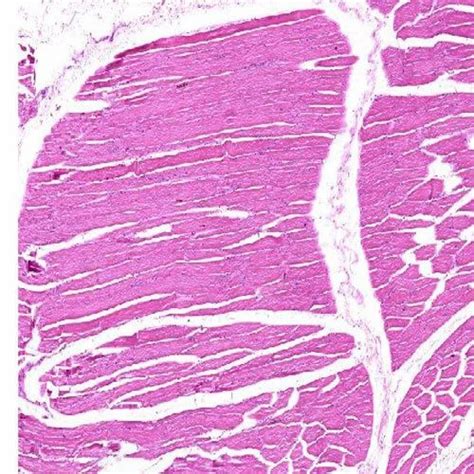 skeletal muscle  microscope