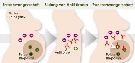 Schwangerschaft Dr Gudrun Lorenz Eberhardt