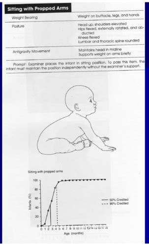 Neuro II Peds Exam Flashcards Quizlet