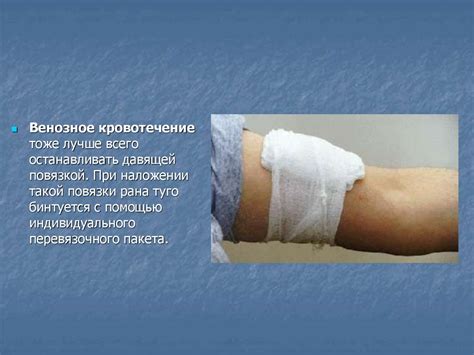 Правила наложения повязок - презентация онлайн