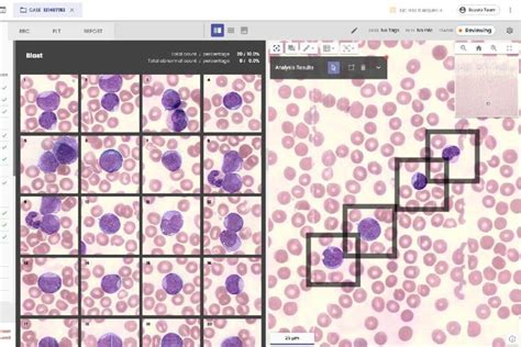 First Full Field Digital Cell Morphology Solution