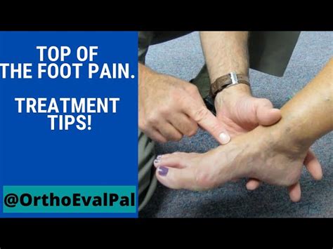 Intermittent Sharp Stabbing Pain On Top Of Foot Hotsell