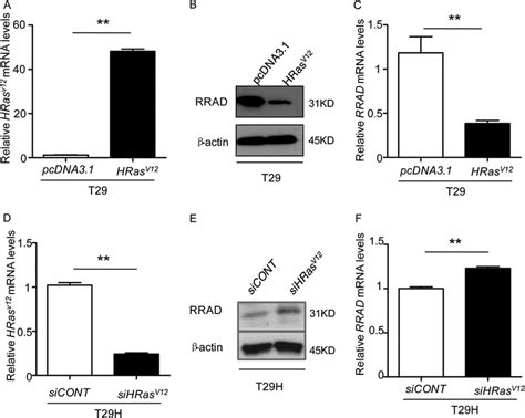 RRAD Expression Is Regulated By HRas V12 A C Overexpression Of HRas