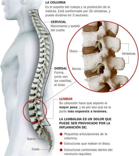 Pin De Farmaciafrancesa En Salud Dolor De Cintura Dolor De Espalda Y