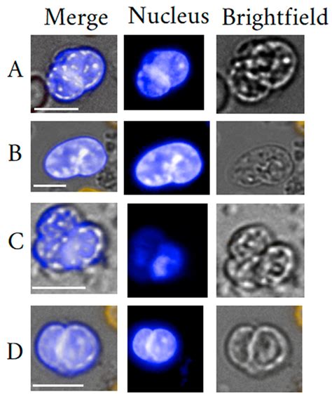 Cells Free Full Text The Blood Circulating Rare Cell Population