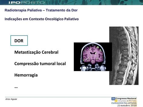 PDF Radioterapia Medicinapaliativa Pt Preditores De Resposta