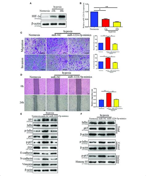 Mir P Mediates The Promoting Effects Of Hypoxia On Metastasis