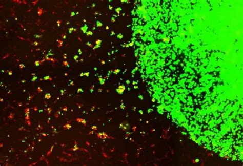 Prueban Con Xito En Ratones C Lulas Madre Para Atacar El Glioblastoma