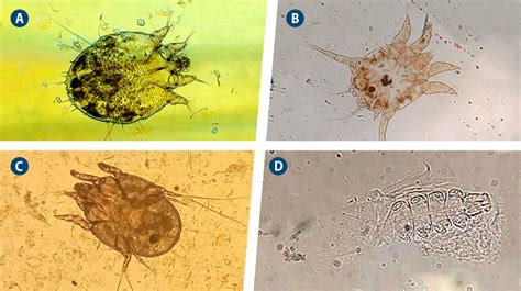 El Parásito Del Mes Las Sarnas En Los Ovinos Y Caprinos Parasitxpert