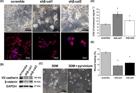 The effects of βcatenin knockdown on the formation of VM and cellular