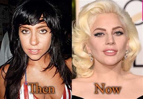 How Did Lady Gaga Plastic Surgeon Plastic Surgery Before And After Celebrity Makeup